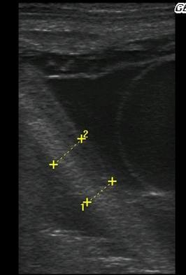 Placentitis_Fig 4